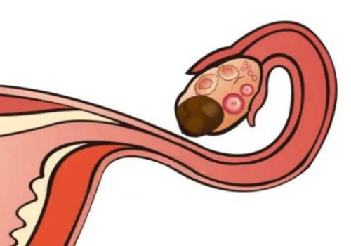 为什么备孕二胎一直怀不上？有哪些可能的原因？