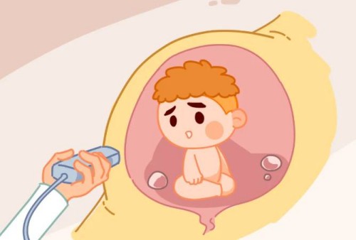 怀孕到了晚期怎么样才能快速分清是简单疼痛还是要生了-